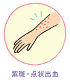 紫斑・点状出血