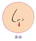 鼻血