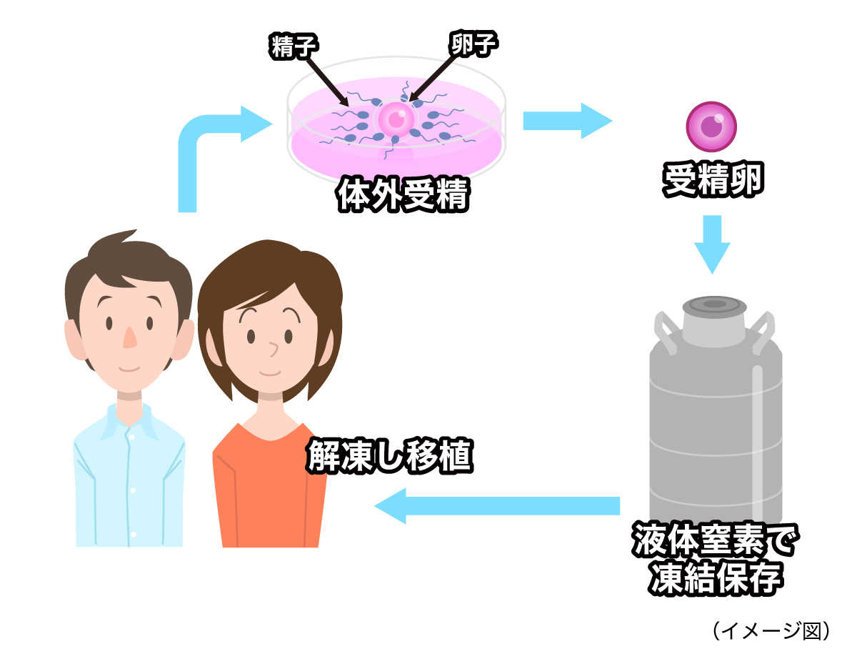 胚（受精卵）凍結［既婚の場合］（イメージ図）