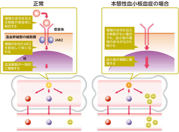 正常時と本態性血小板血症における造血