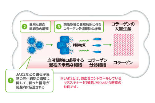 骨髄線維症が起こるしくみ