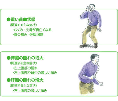 骨髄線維症の進行・悪化を示すサイン