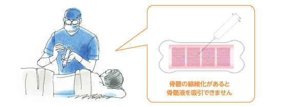 骨髄液の吸引方法