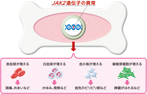 JAK2遺伝子の異常