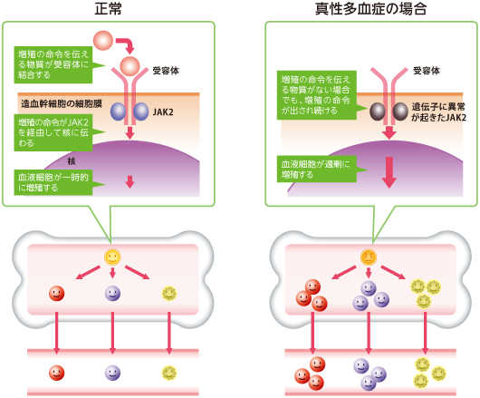 正常時と真性多血症における造血