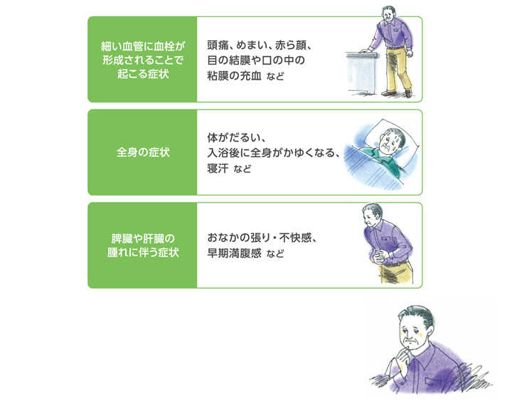 真性多血症の主な症状