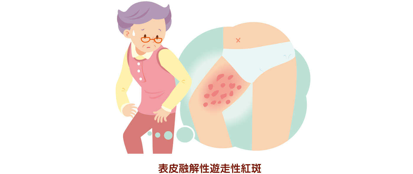 グルカゴノーマが疑われるとき