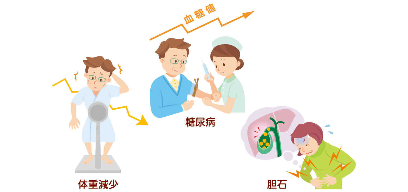 ソマトスタチノーマが疑われるとき