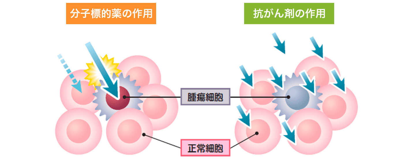 分子標的治療薬と抗がん剤のちがい 分子標的治療薬と抗がん剤のちがい