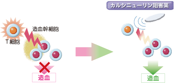 免疫抑制療法:カルシニューリン阻害薬