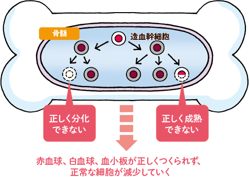 造血幹細胞が正しく「分化・成熟」できなくなる