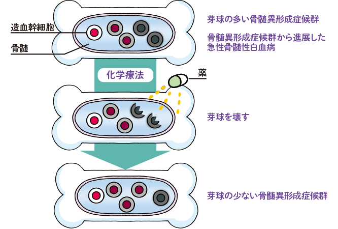化学療法って何?