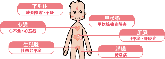 鉄を身体の外に排出するしくみは?