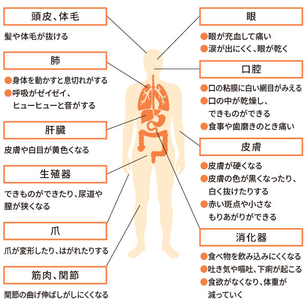 【頭皮、体毛】髪や体毛が抜ける【肺】・身体を動かすと息切れがする・呼吸がゼイゼイヒューヒューと音がする【肝臓】皮膚や白目が黄色くなる【生殖器】できものができたり、尿道や膣が狭くなる【爪】爪が変形したり、はがれたりする【筋肉、関節】関節の曲げ伸ばしがしにくくなる【眼】・眼が充血して痛い・涙が出にくく、眼が乾く【口腔】・口の粘膜に白い網目がみえる・口の中が乾燥し、できものができる・食事や歯磨きのとき痛い【皮膚】・皮膚が硬くなる・皮膚の色が黒くなったり、白く抜けたりする・赤い斑点や小さな もりあがりができる【消化器】・食べ物を飲み込みにくくなる・吐き気や嘔吐、下痢が起こる・食欲がなくなり、体重が減っていく