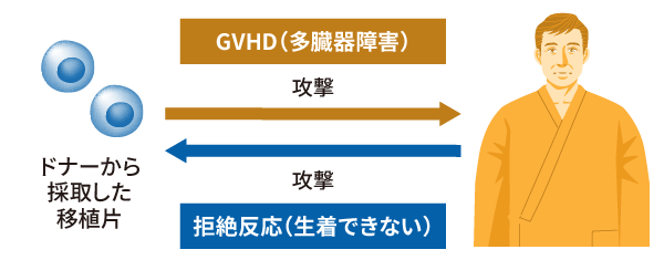 イメージ画像:GVHDと拒絶反応の違い