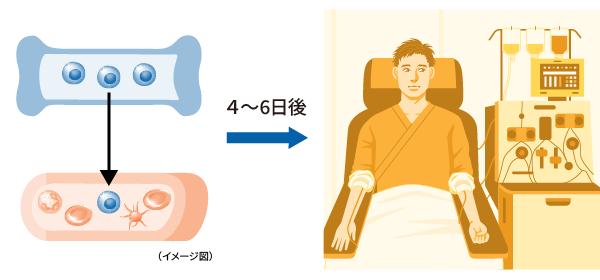 イメージ画像:末梢血幹細胞の採取