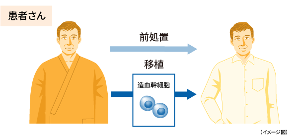 イメージ画像:自家移植