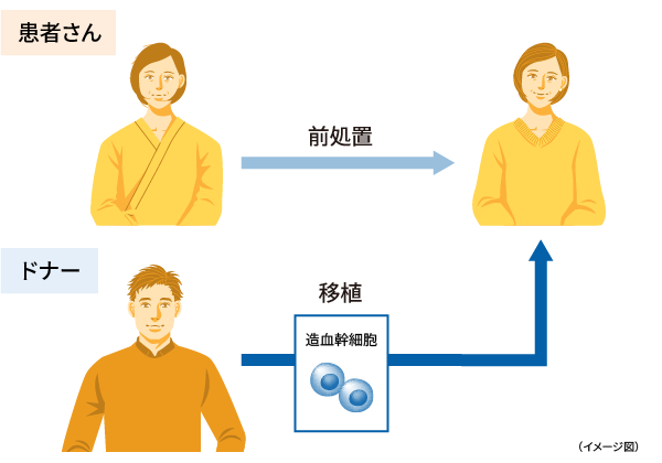 イメージ画像:同種移植