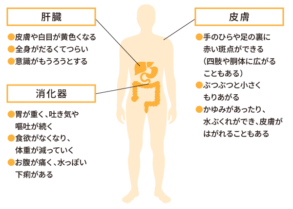 【肝臓】・皮膚や白目が黄色くなる・全身がだるくてつらい・意識がもうろうとする【消化器】・胃が重く、吐き気や嘔吐が続く・食欲がなくなり、体重が減っていく・お腹が痛く、水っぽい 下痢がある【皮膚】・手のひらや足の裏に赤い斑点ができる(四肢や胴体に広がることもある)・ぶつぶつと小さくもりあがる・かゆみがあったり、水ぶくれができ、皮膚がはがれることもある