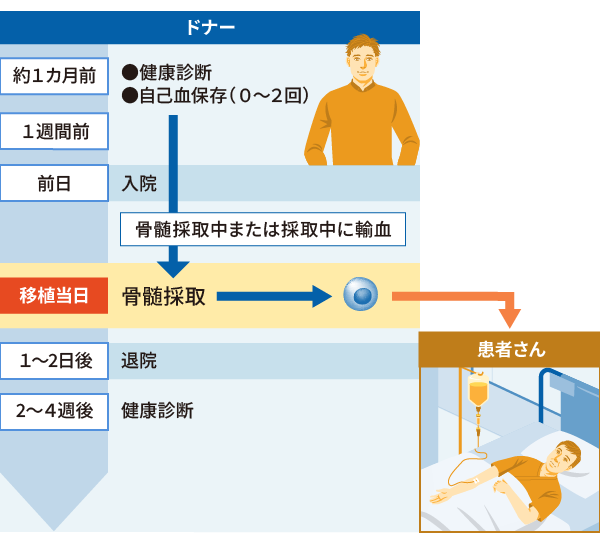 画像：骨髄の採取と移植のながれ