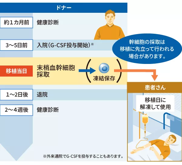 画像：末梢血幹細胞採取のながれ