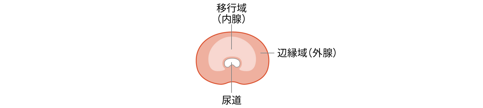 画像：前立腺の構造とがんが発生しやすい場所