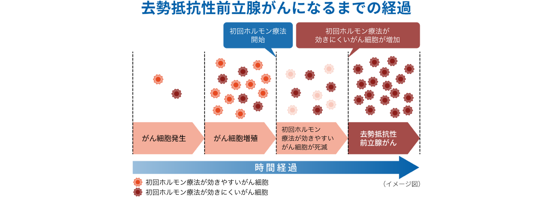 画像:去勢抵抗性前立腺がんになるまでの経過
