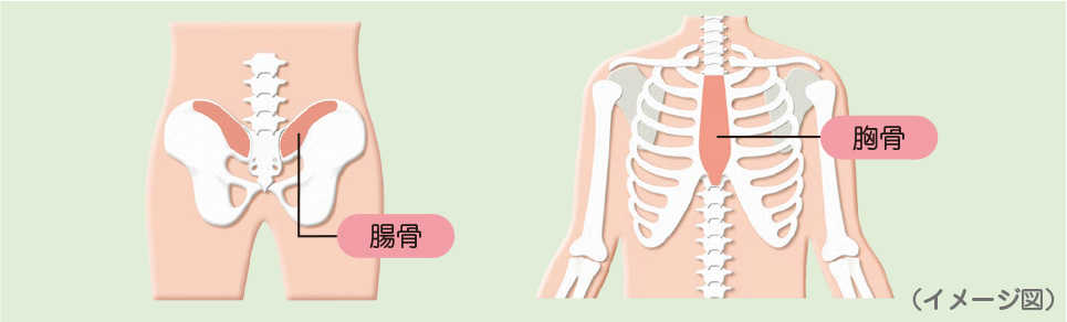 骨髄生検のしかた