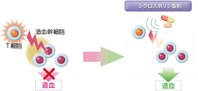 免疫抑制療法:カルシニューリン阻害薬