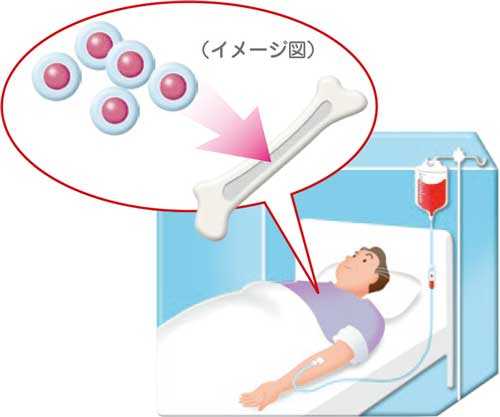 患者のイメージ