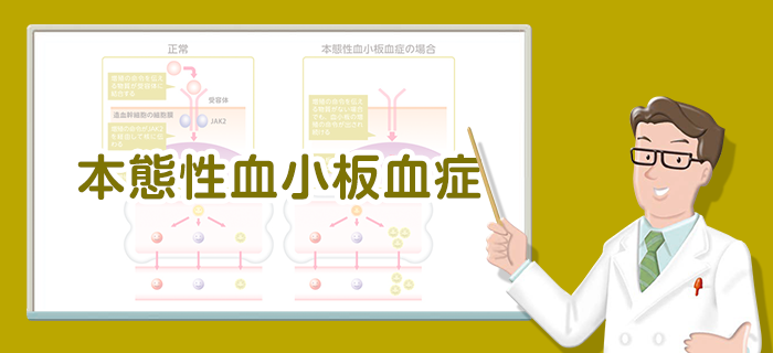 本態性血小板血症