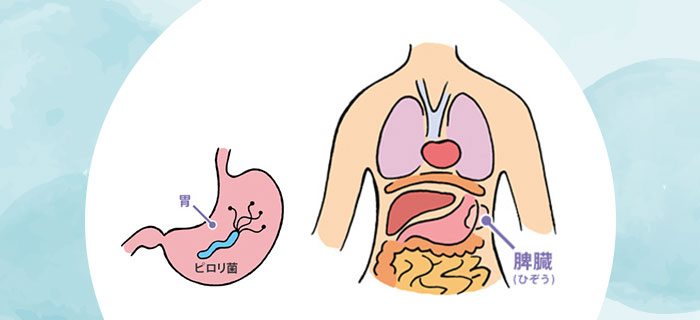 ITPと診断されたら