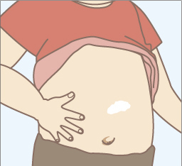 白斑のイラスト