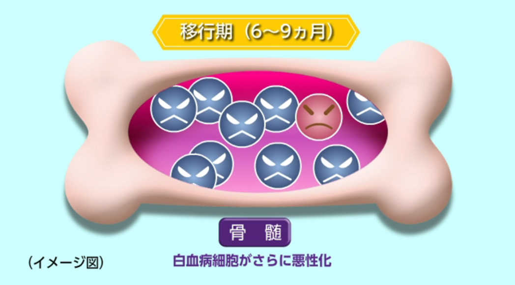 CMLの移行期のイメージ