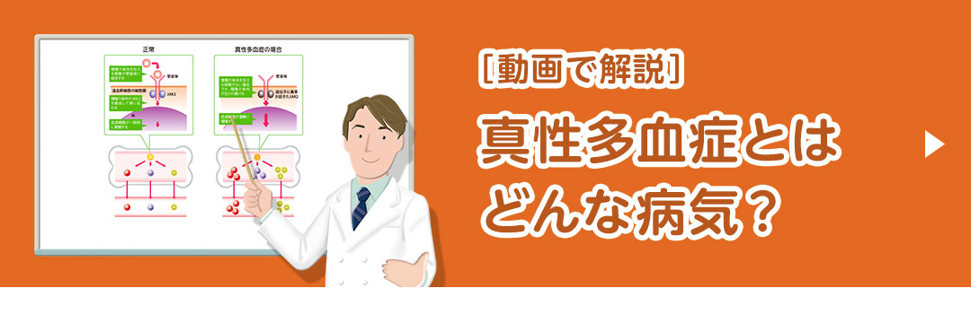 動画で解説：真性多血症とうまく付き合っていくために