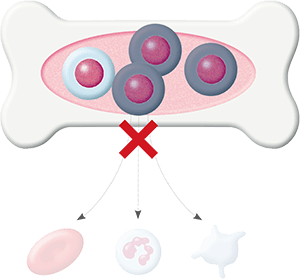 血液細胞が減少するイメージ