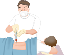 骨髄穿刺のしかた