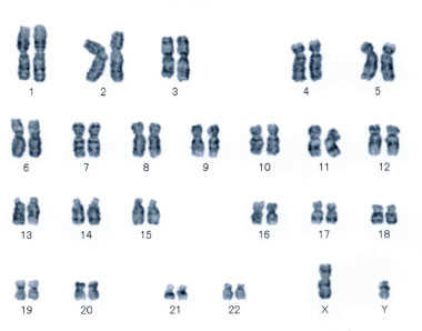 正常な場合の染色体
